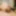 The head of the penis without the foreskin  #2