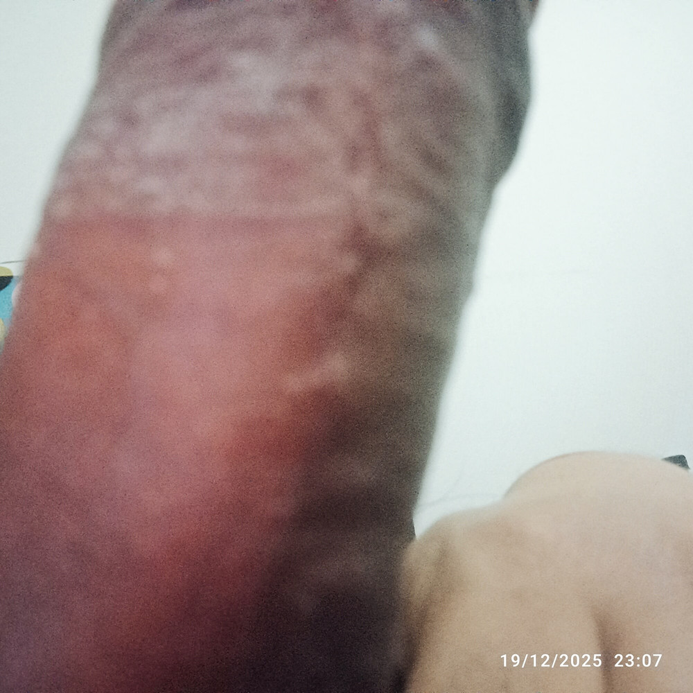 Paloma gruesa de un boliviano #10