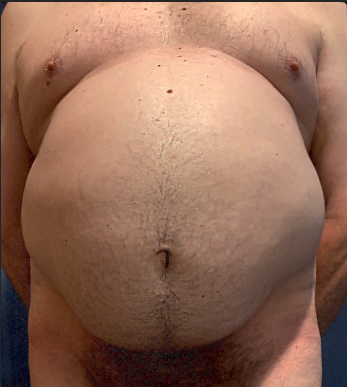 Ximd9000 Big Bloated Belly #5