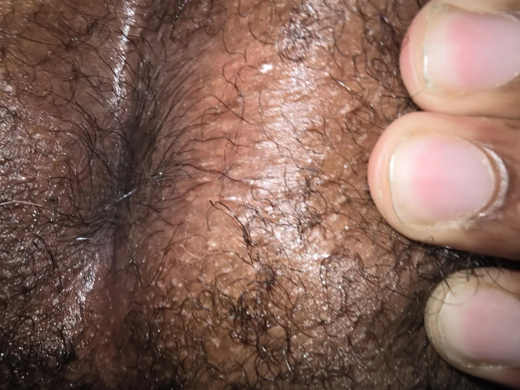 My Ass #24