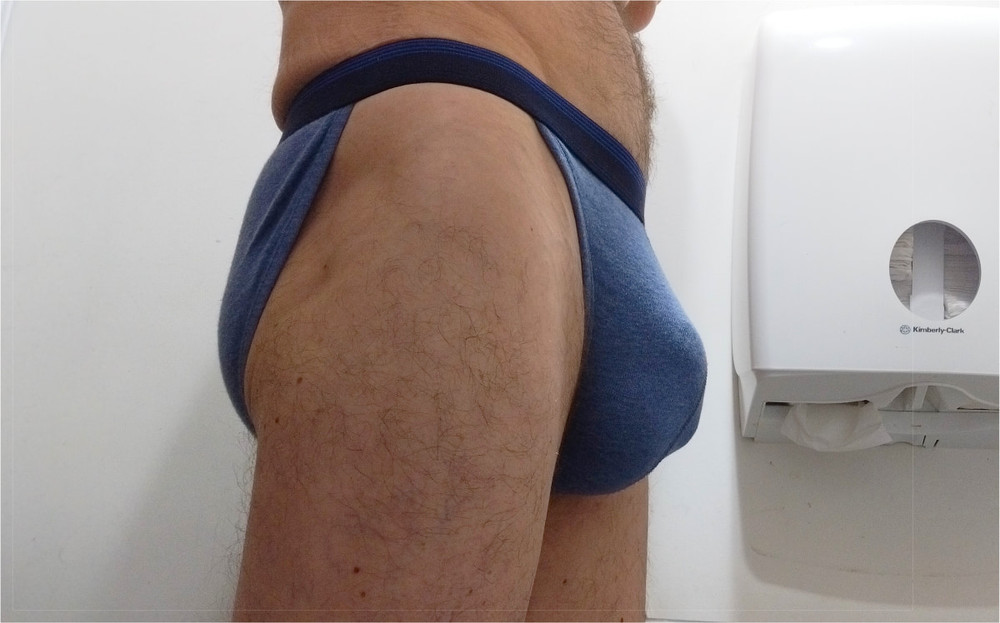 Hypospadias UK - In my favourite hot underwear. #8