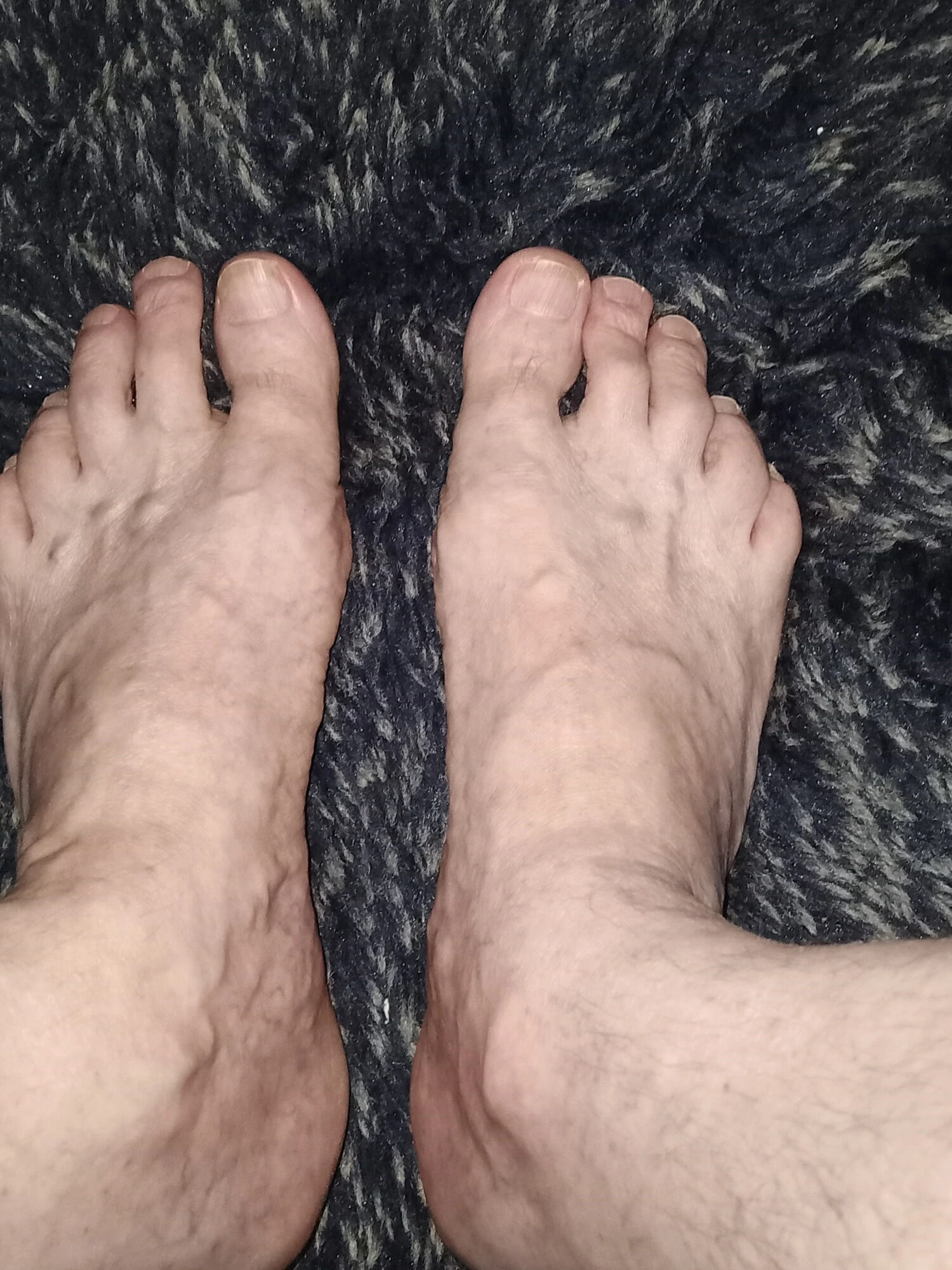 Feet 