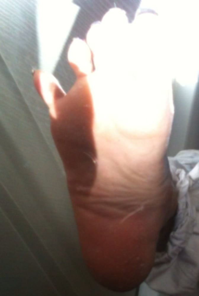 Blue toenails under sun ray #28