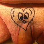 Micropenis #9
