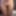 Smooth vulva 