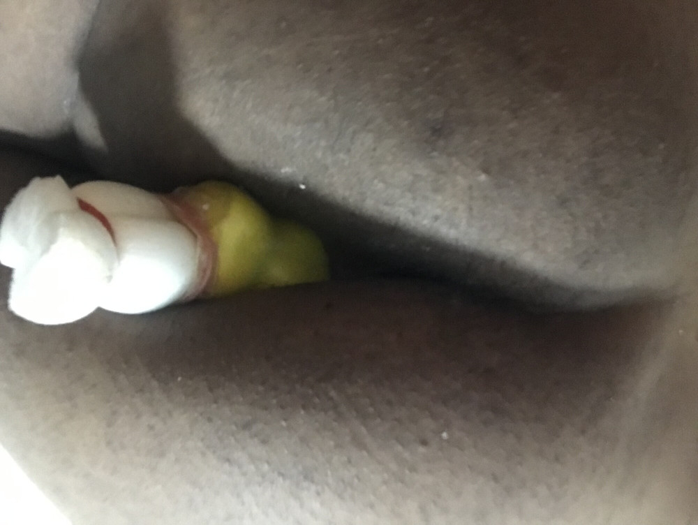 Amateur chubby small dick play anal  #49