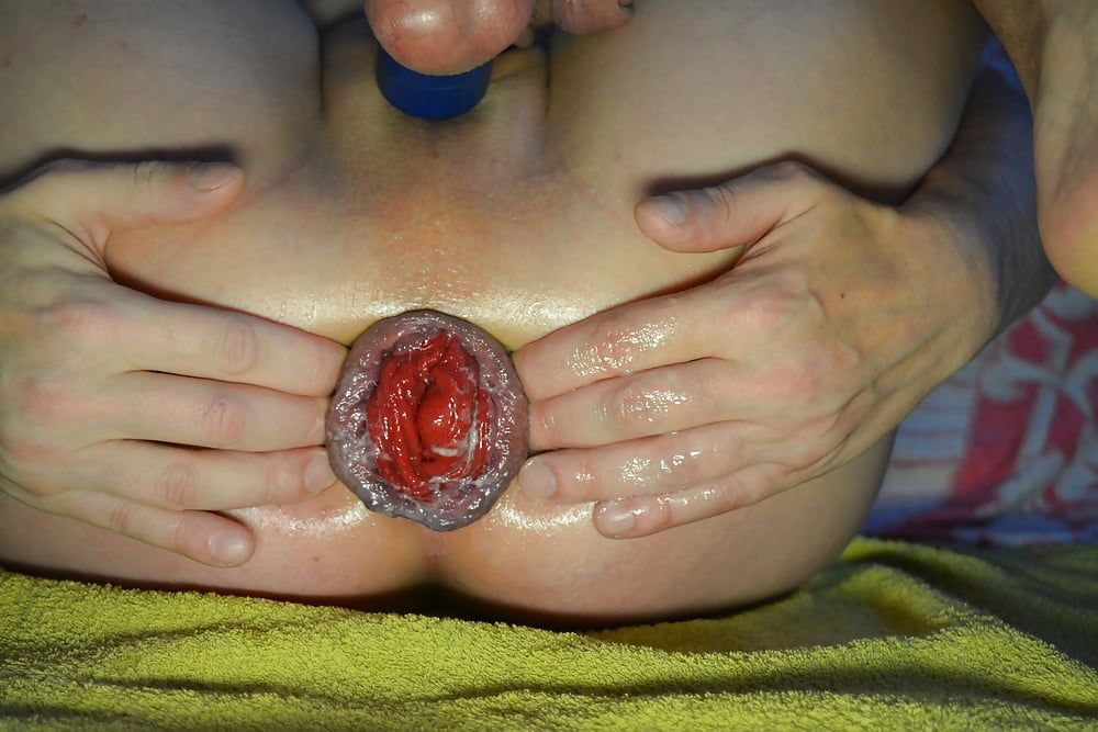 extreme prolapse pumping #8