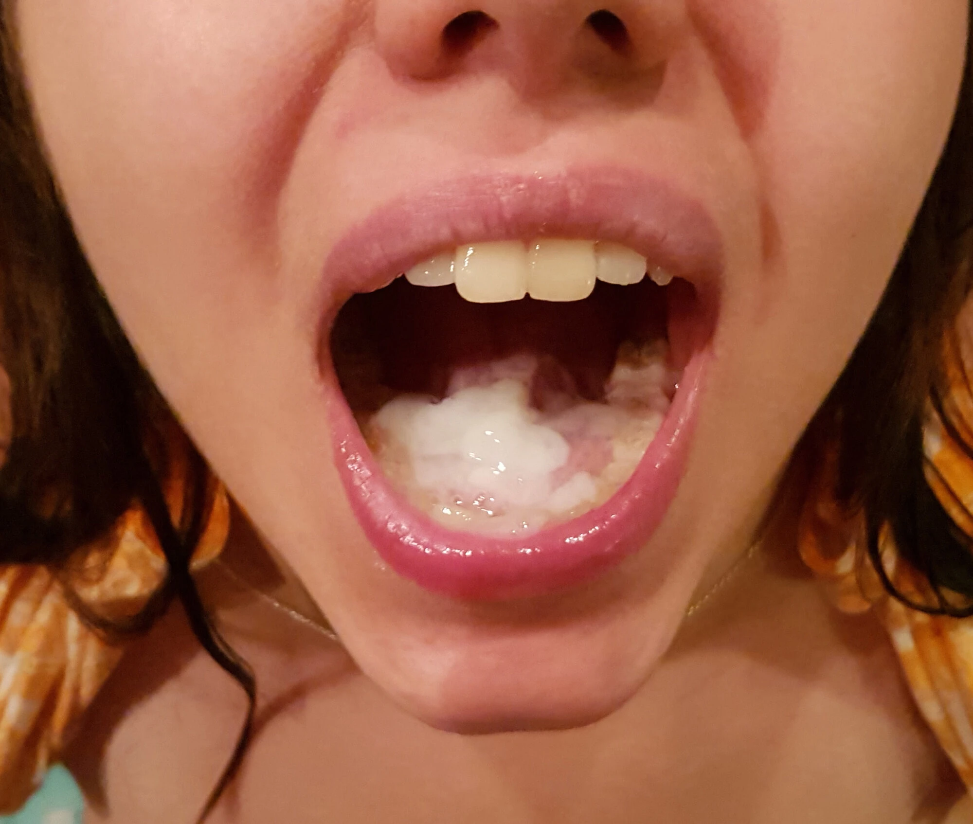 open mouth