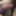 包皮を引っ張る - 包皮の修復 - 2025年8月