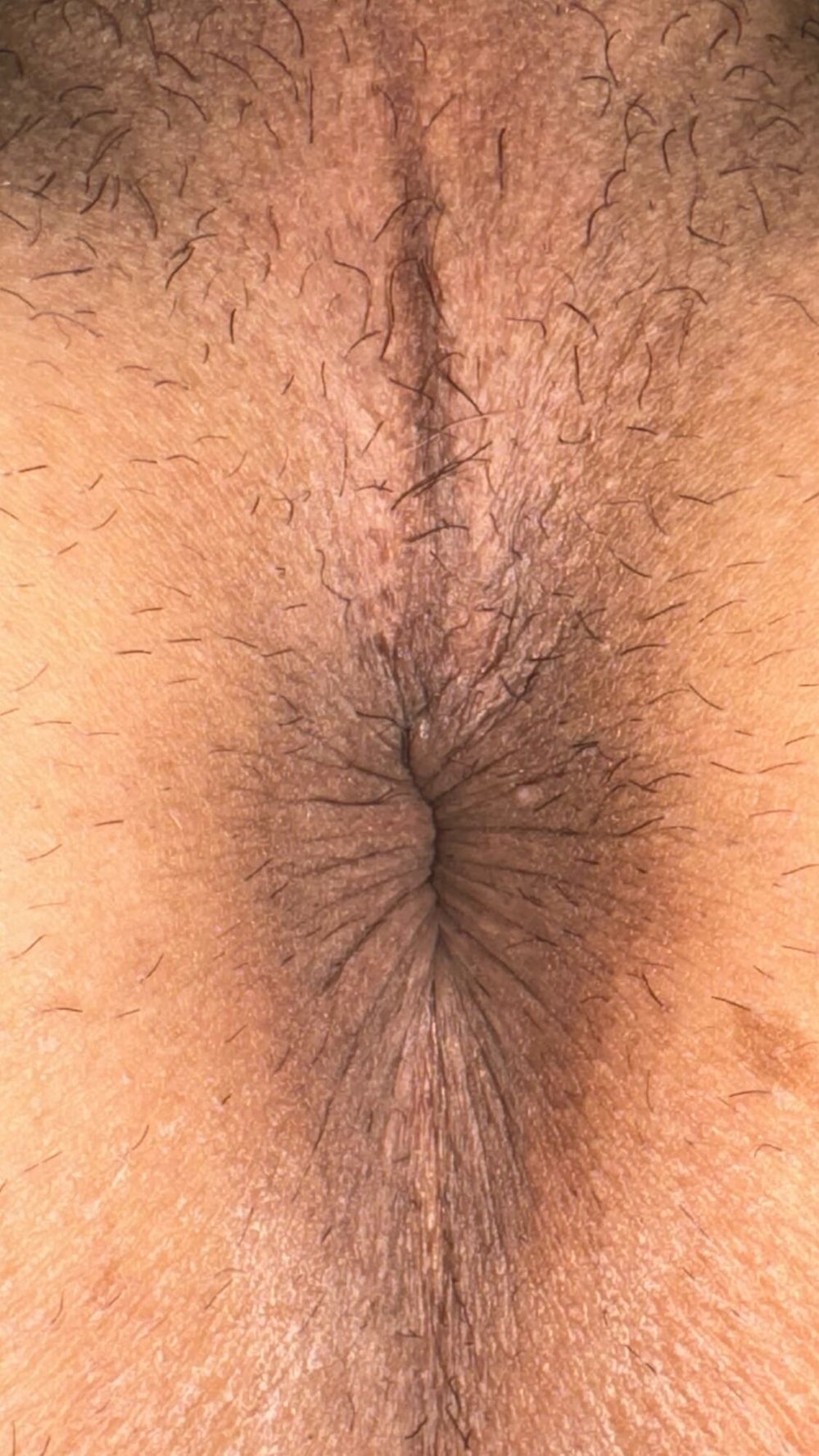 my anus #33