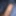 My foreskin