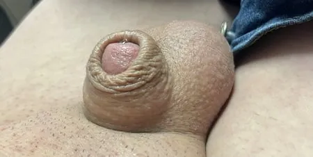 inverted tiny penis         