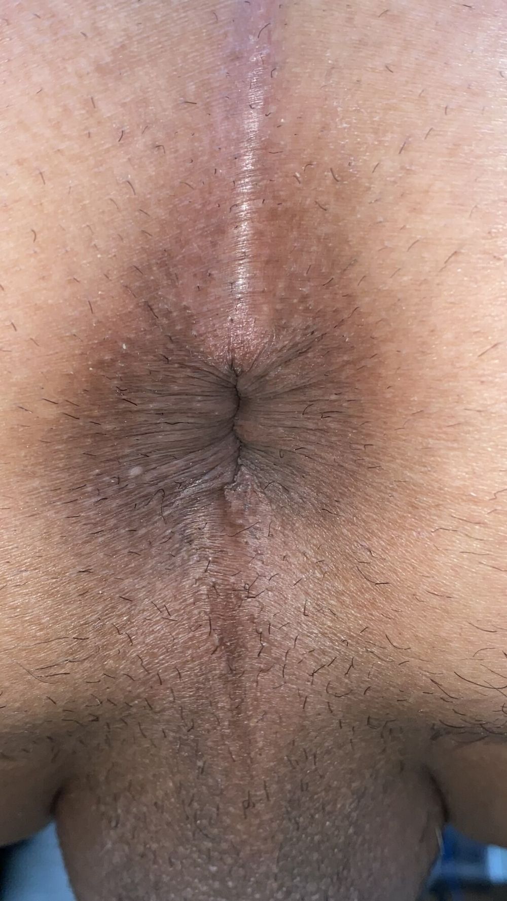 Close-up of a man&#039;s anus #5