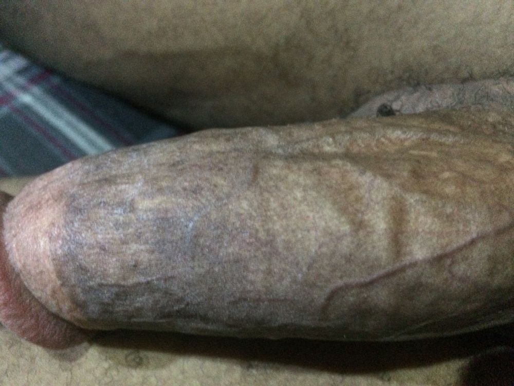 My Big Dick #6