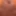 My foreskin #2