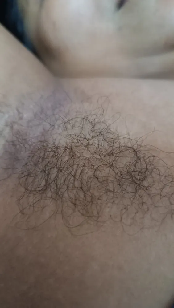 My Hairy Armpits 