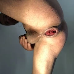 wide apart lips