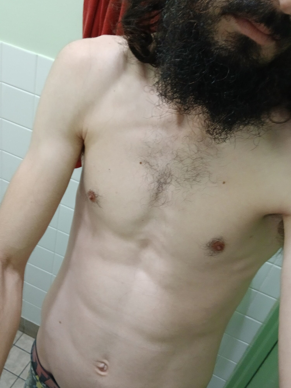 Exhib  #3