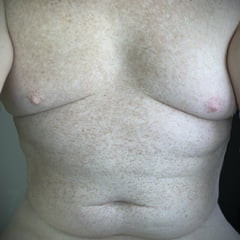 For You Freckle Lovers