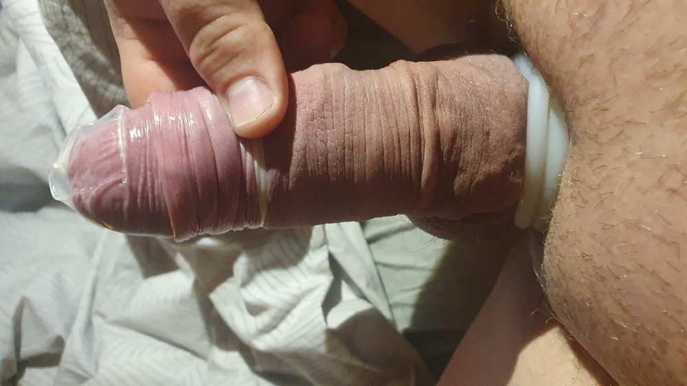 Penis #20