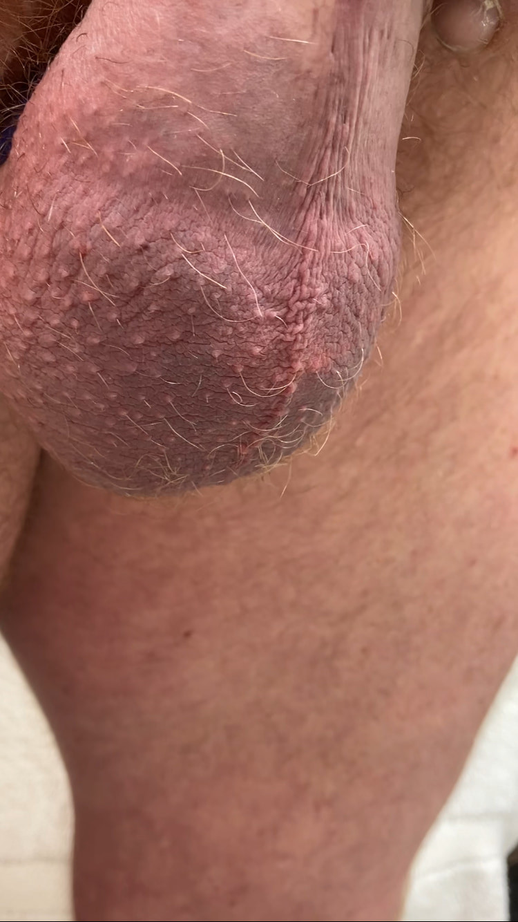 Compilation of uncut cock pics #6