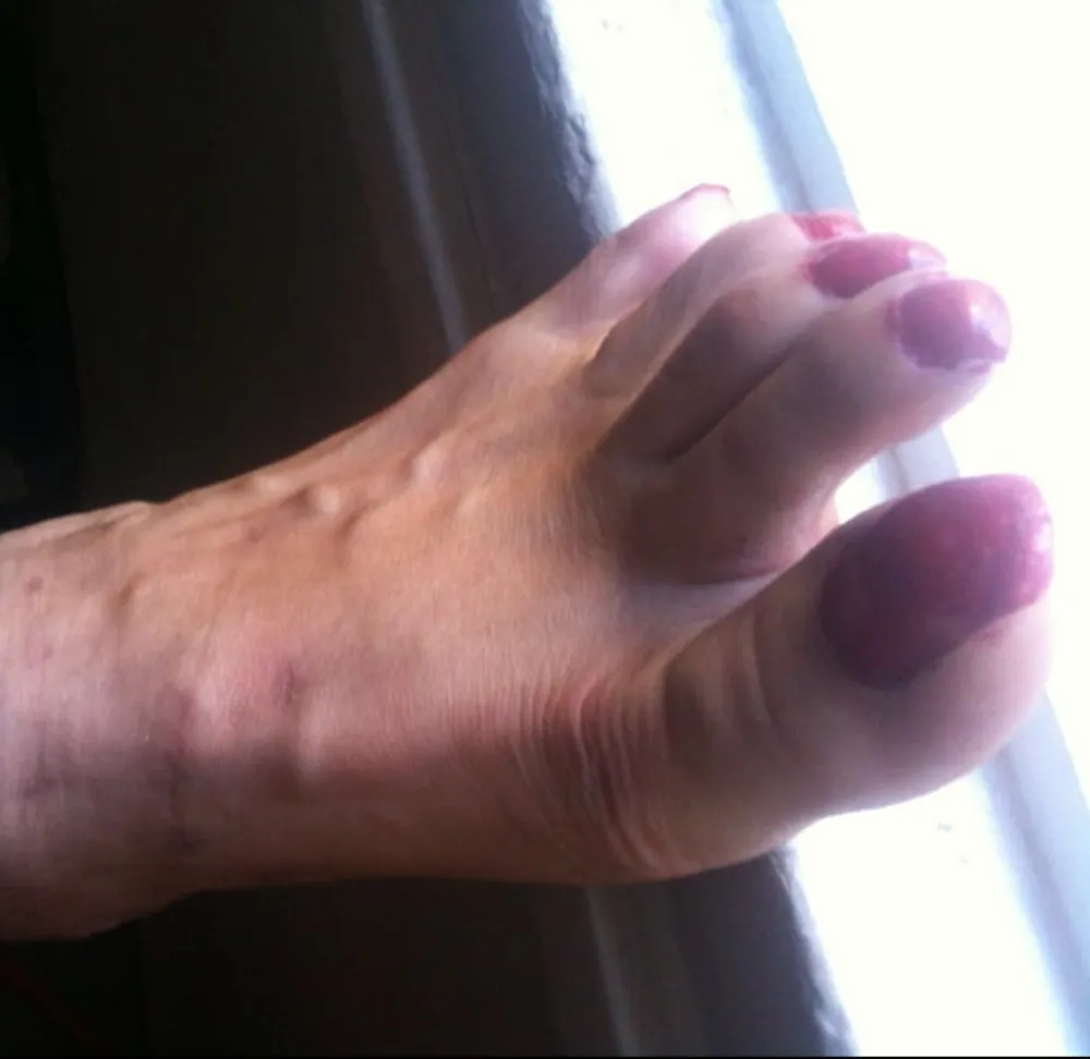 red toenails mix (older, dirty, toe ring, sandals mixed).