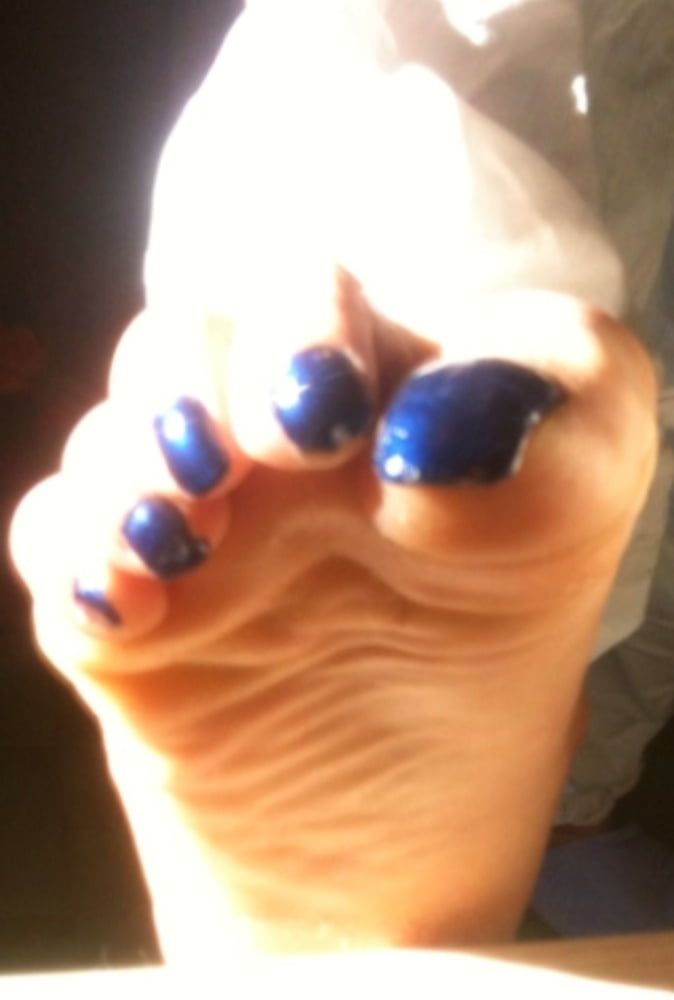 Blue toenails under sun ray #22