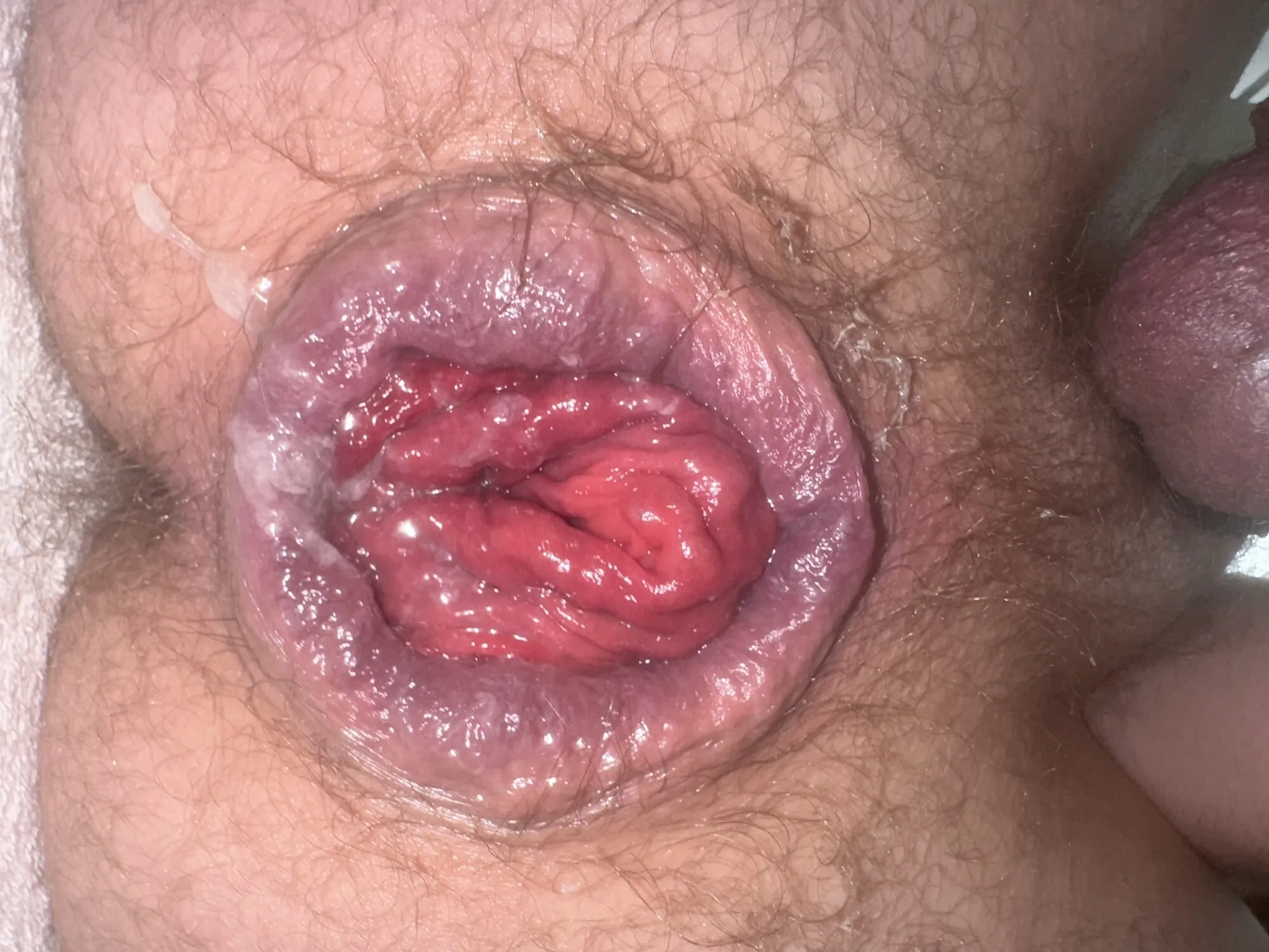 Anal prolapse in oxball ff pighole