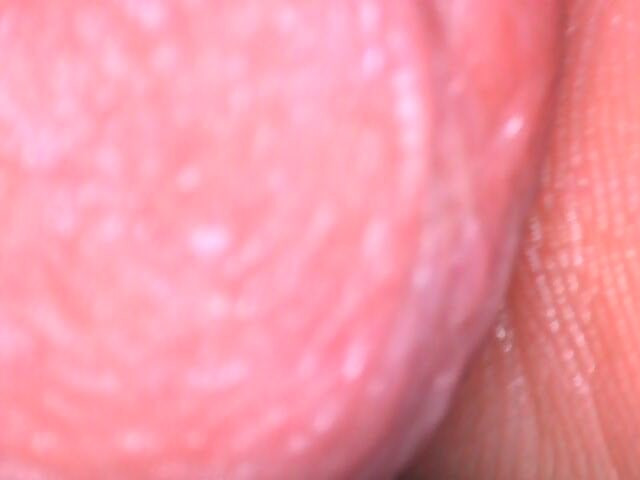 Saline Injection #32