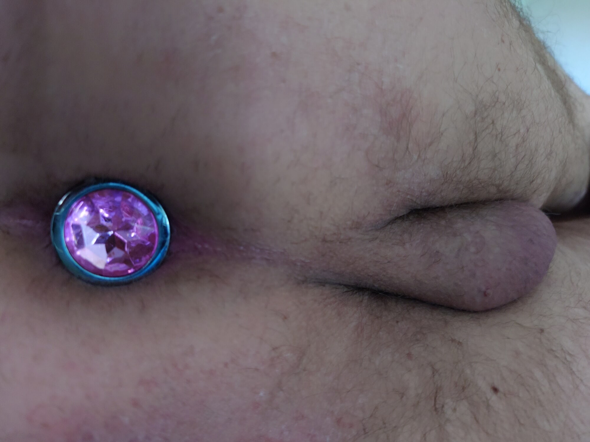Anal tap