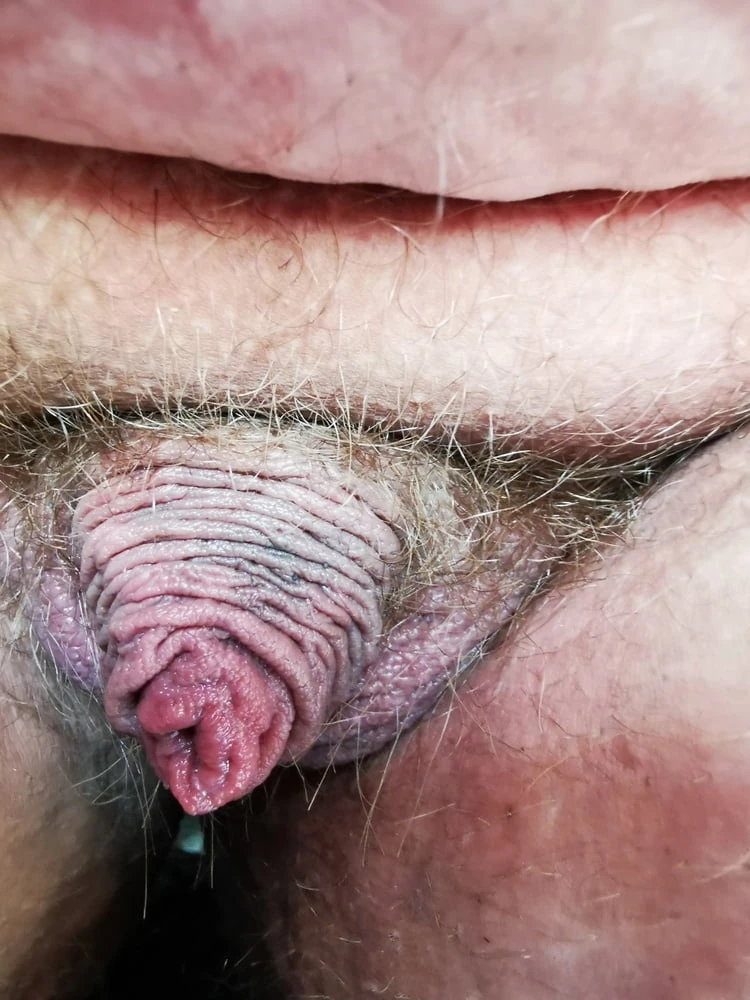 Worlds Smallest Dick?  #13