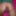 MY OPEN ASS AFTER AN INTENSE ANAL. PART TWO #3