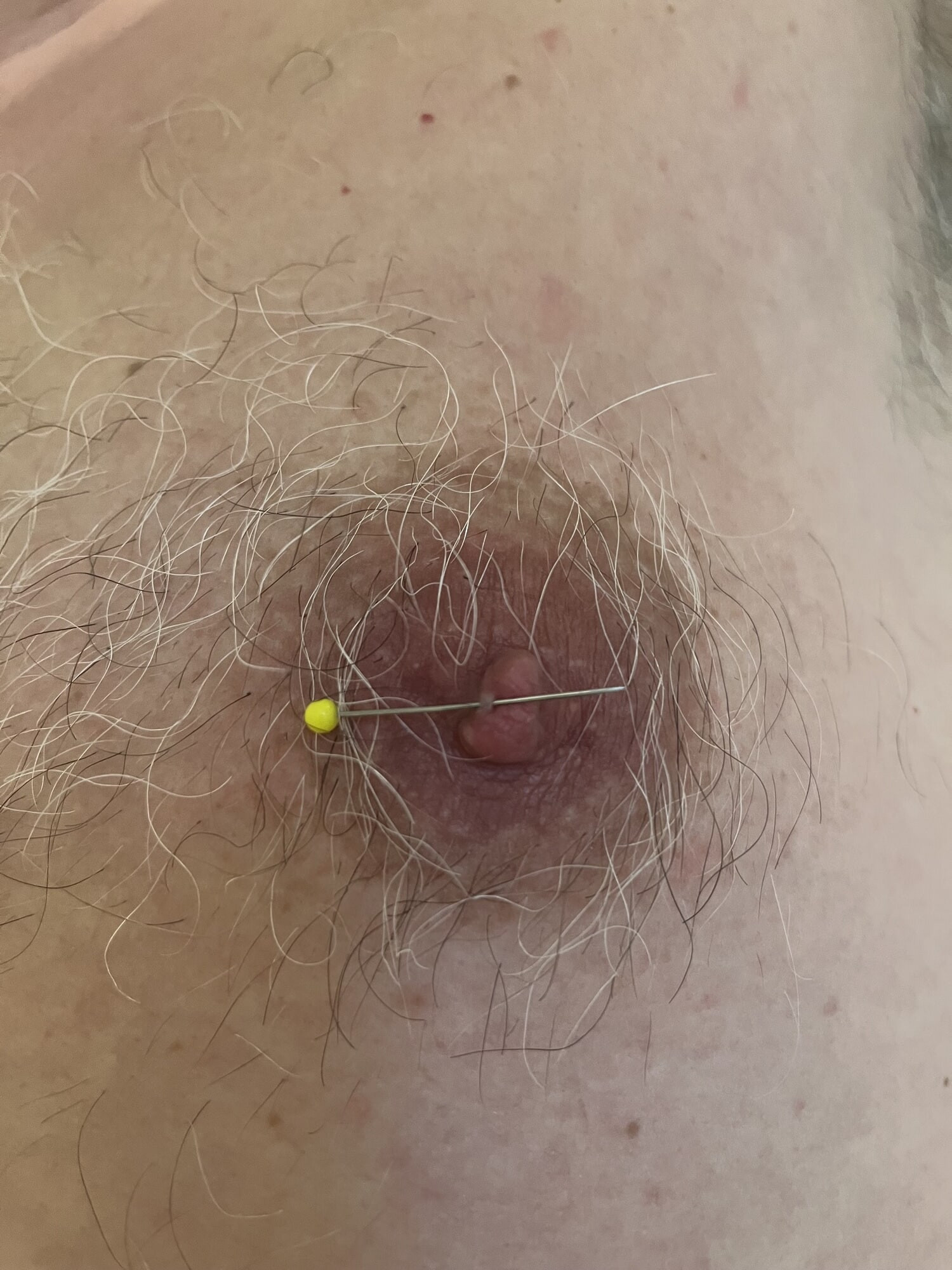 Different insertions #7