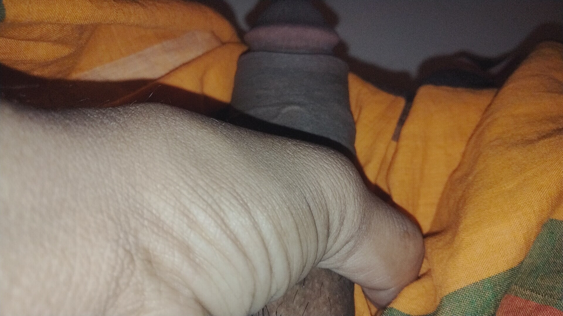 Dick is swollen and the veins are sticking out