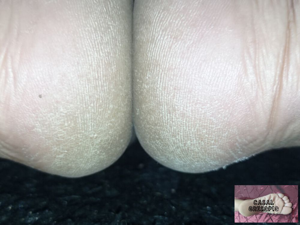 GRESOPIO FEET #38