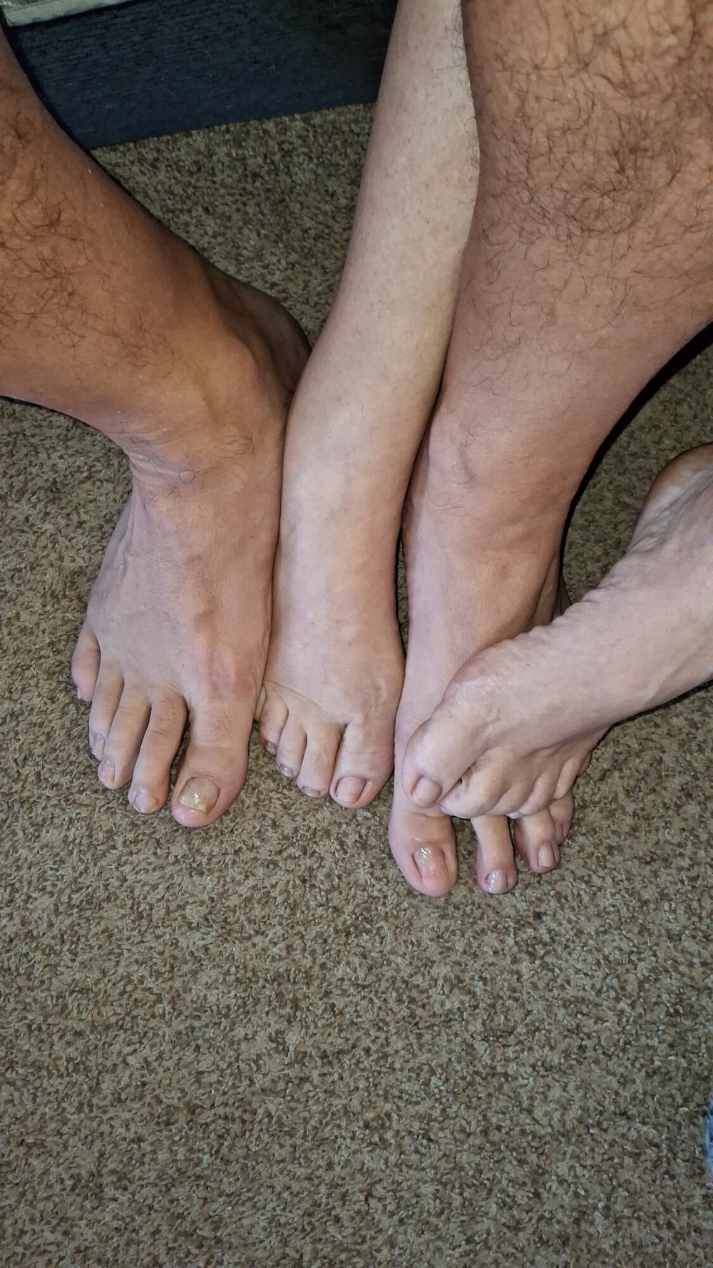 Showing off our un polished toes #10