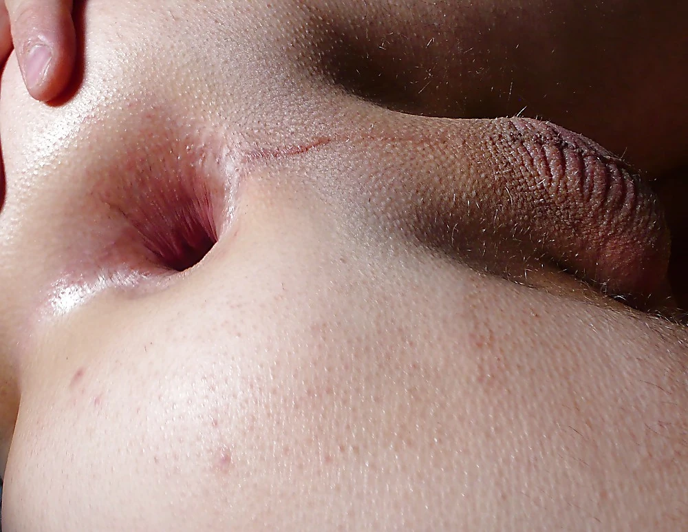 2011 two month without gaping- My asshole closed 