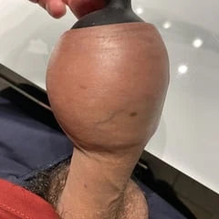 Extreme foreskin inflation porn