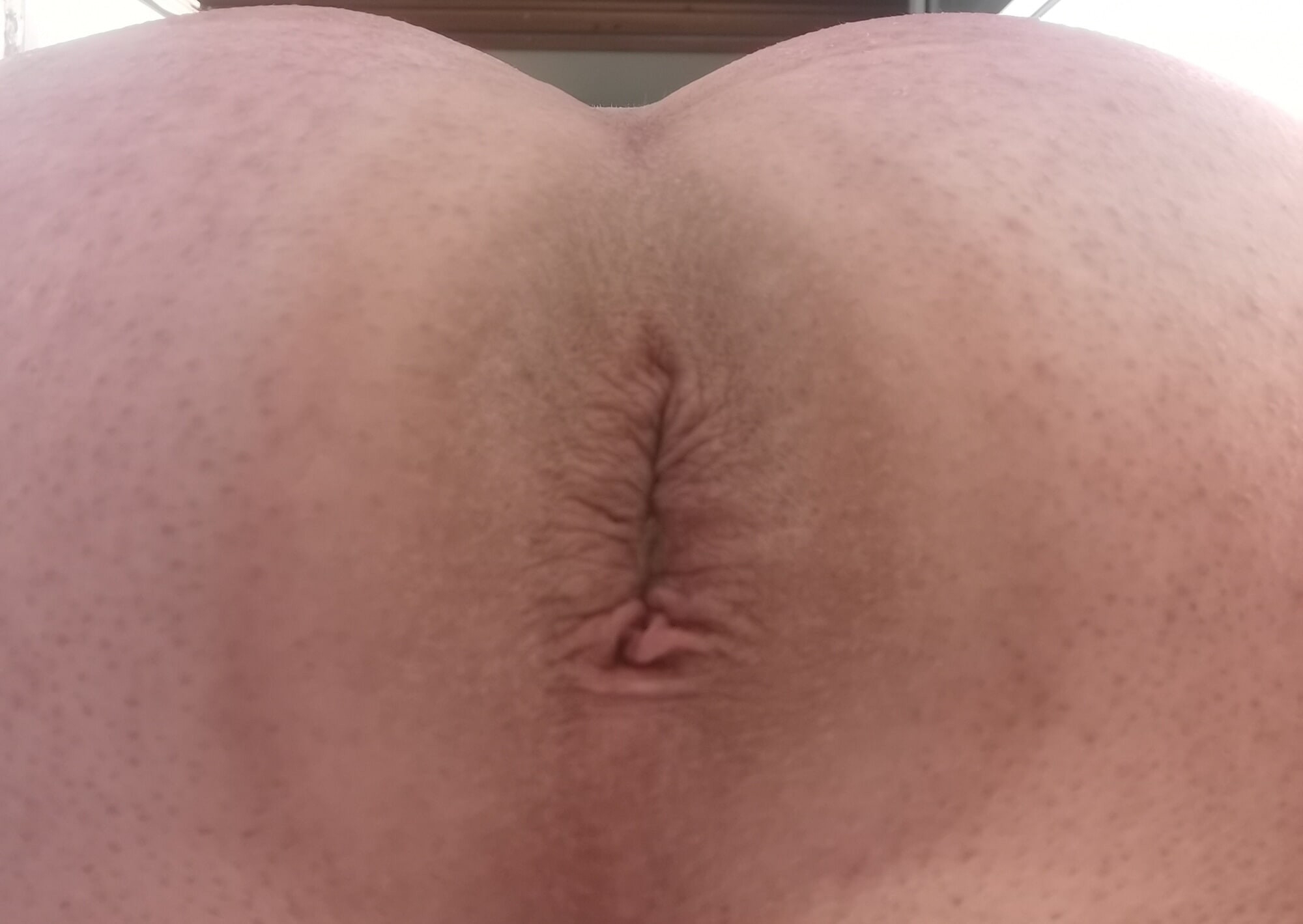 My asshole