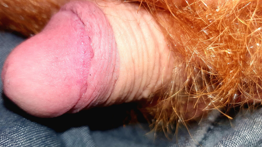 Fire bush #9