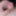 Close up foreskin and glans #3