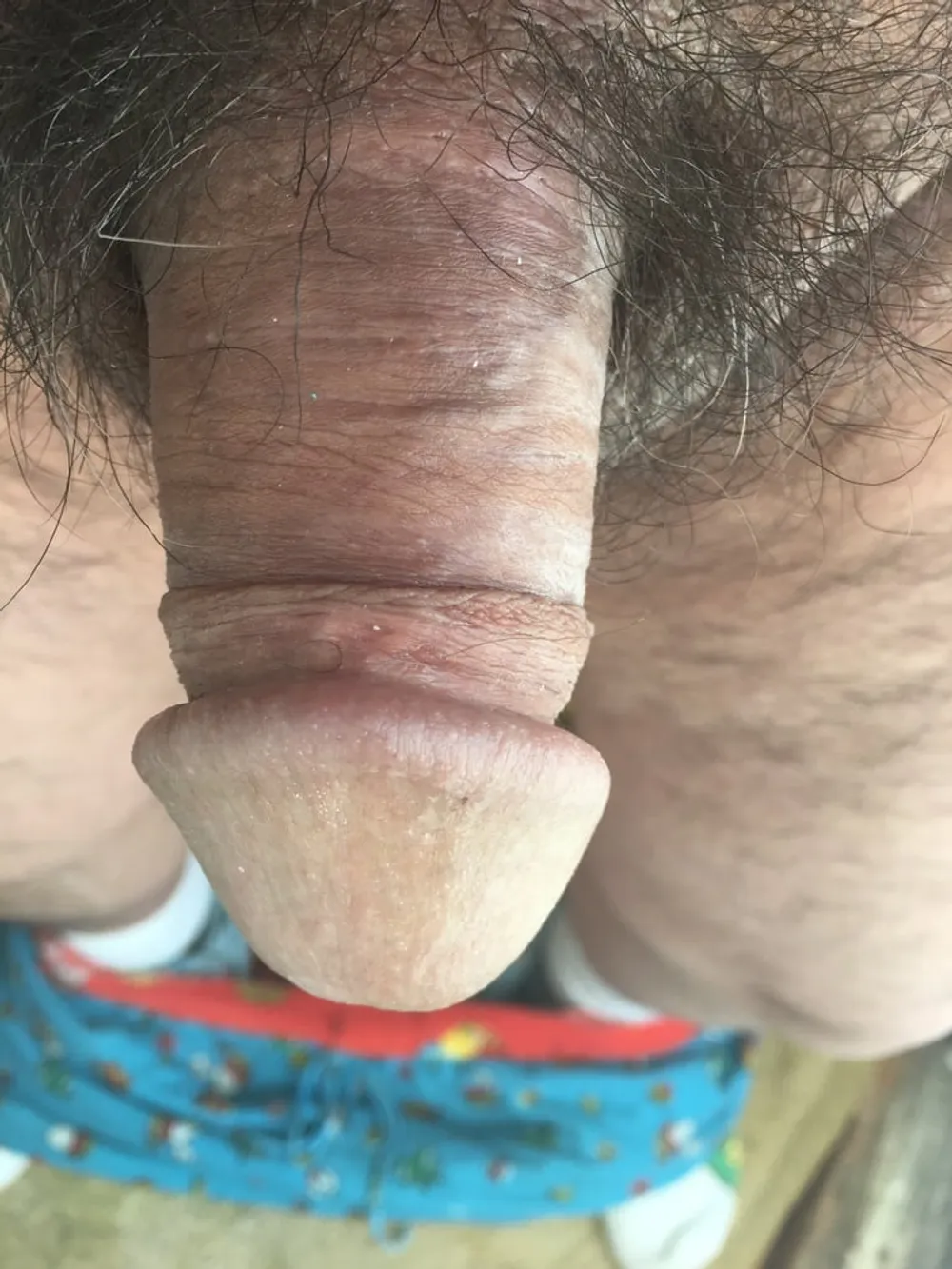 More of my Dick and nudes #5