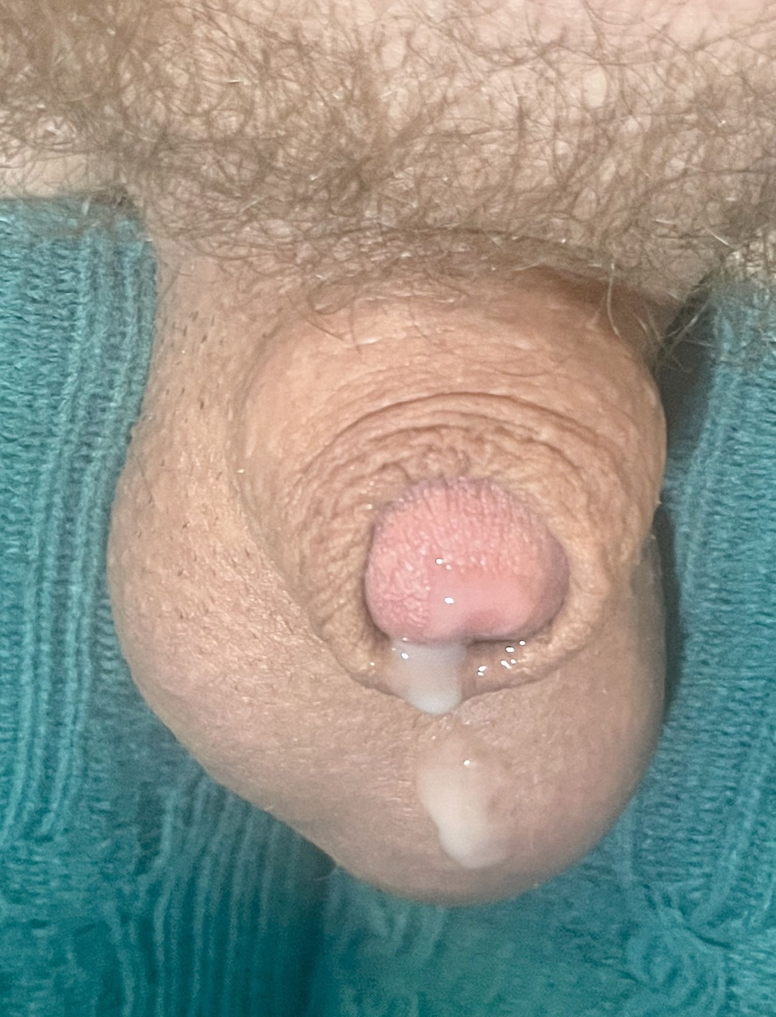 Micropenis lady, boy, cock pic #8