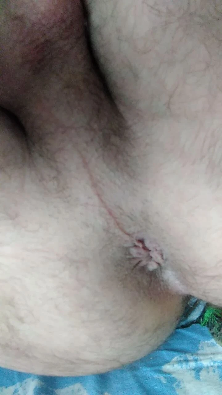 My ass #2