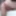 My body