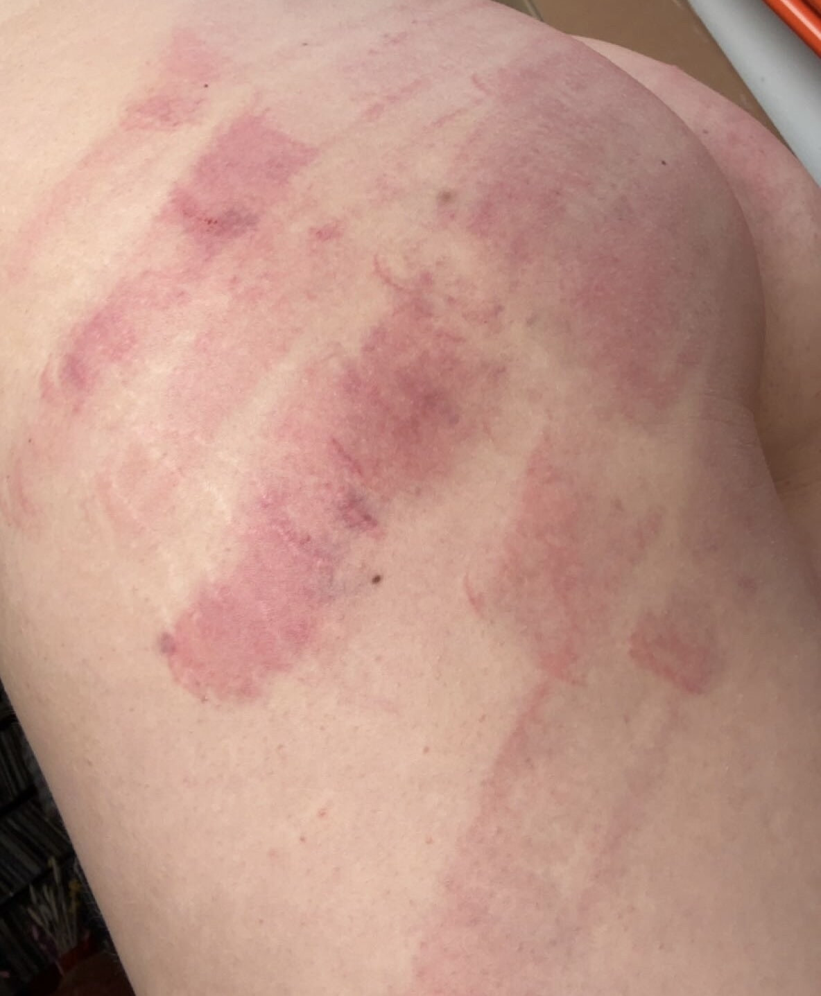 SklavinS extremely whipped ass