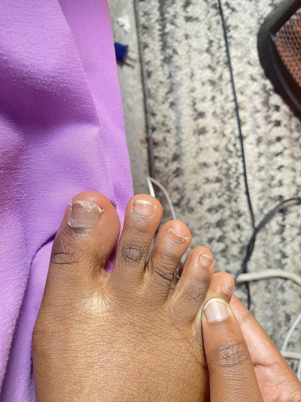 Need A Online Rich Sugar Daddy To Pay For My Pedicure #2