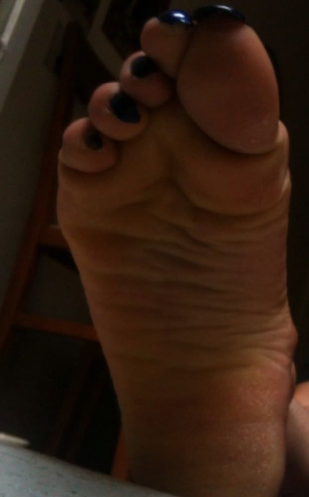 blue toenails and soles feet after day at beach  #10