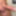 Dick