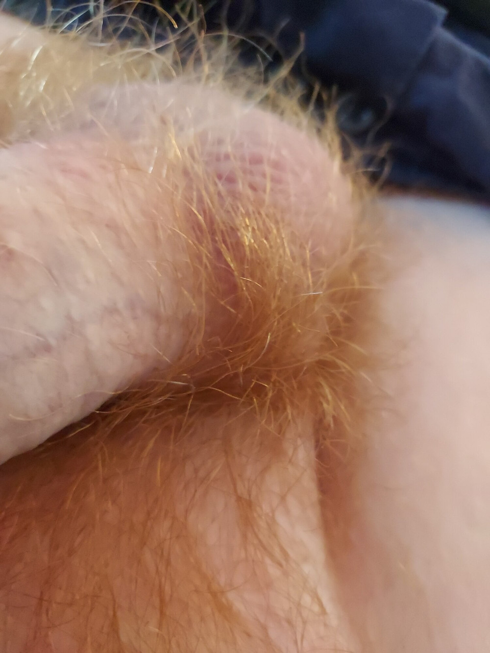 Fire bush #5